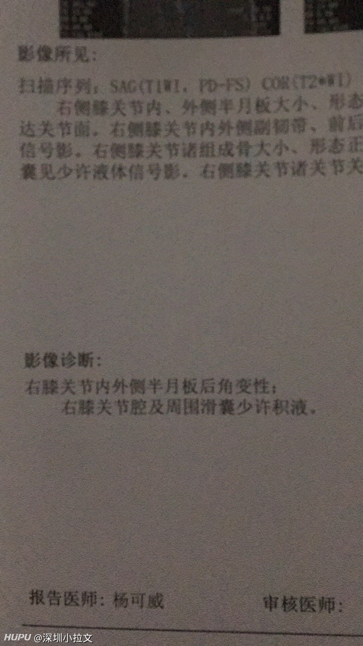 超爱运动半月板后角一级变性问了好几个医生意见不一不知道怎么办