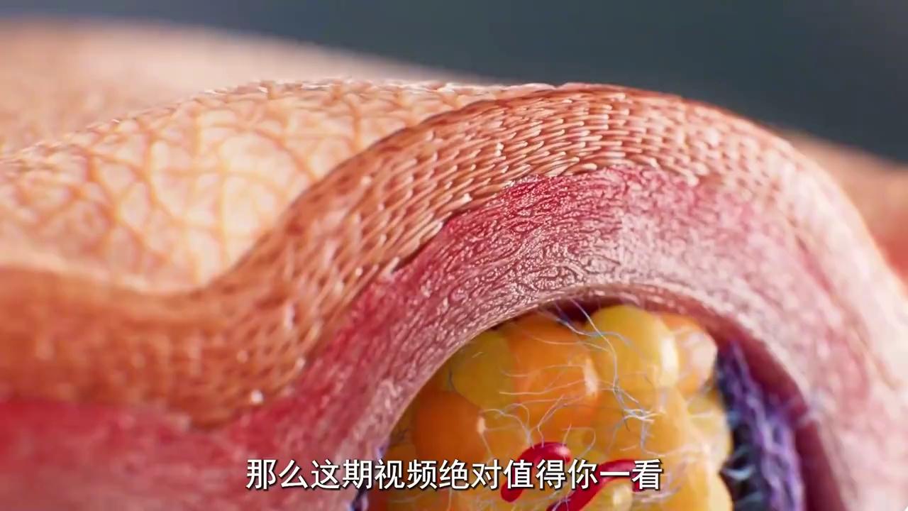 video-poster