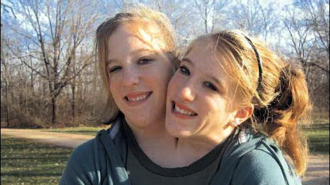 这辈子,我们永不分离.下辈子……还是算了吧!【连体人,不适者勿点击】