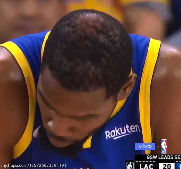 小帅杜兰特是不是秃顶了