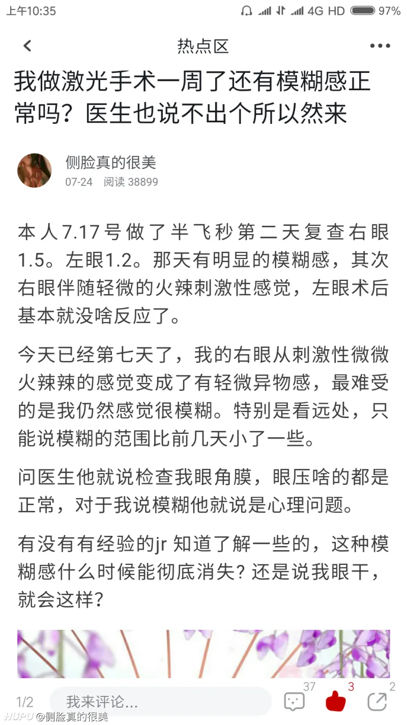再发一贴关于近视眼激光手术 步行街主干道 虎扑社区
