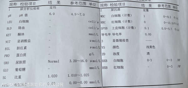复查肌酐正常咯