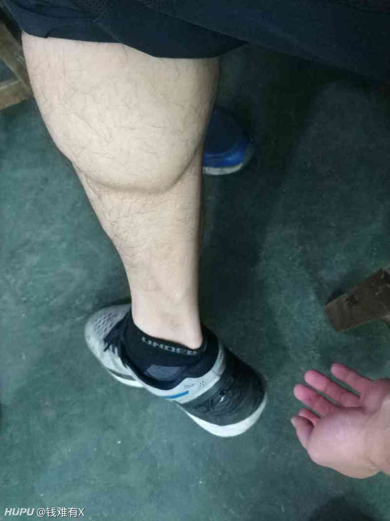 我这跟腱什么水平,算长吗