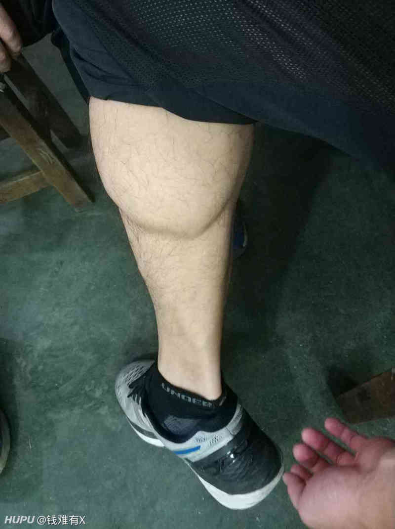 我这跟腱什么水平,算长吗