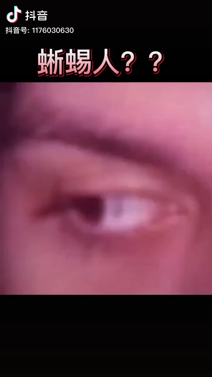 video-poster